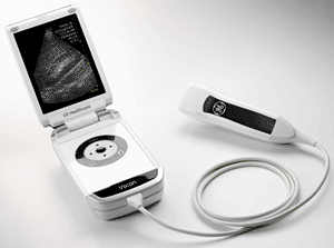 Image: The pocket-sized Vscan visualization tool (Photo courtesy of GE Healthcare).